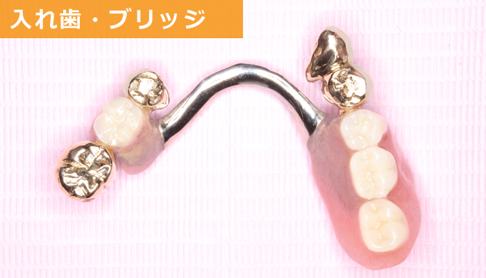 埼玉県の入れ歯作製の上手な歯医者・いしはた歯科クリニック